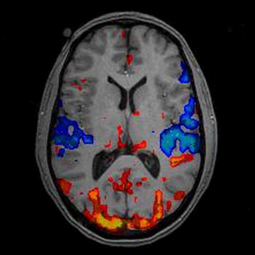 fMRI Activation