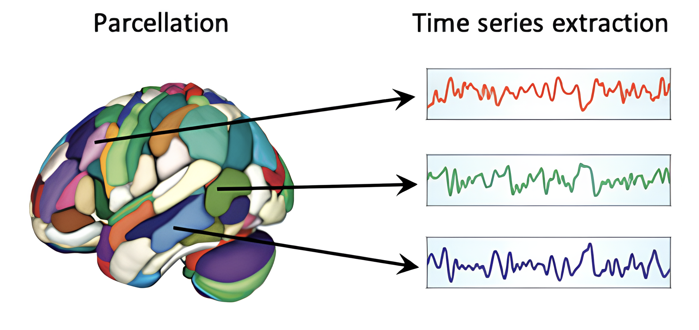 Illustration of the process of extracting regional time series from a parcellated brain. After the brain is divided into regions, the fMRI signal from all voxels within each region is summarized into a single time series that describes how activity in that region fluctuates over time. These regional time series form the basis of many downstream analyses, including resting-state functional connectivity and graph-theoretical network analysis. Adapted from https://doi.org/10.1016/B978-0-323-85280-7.00002-6