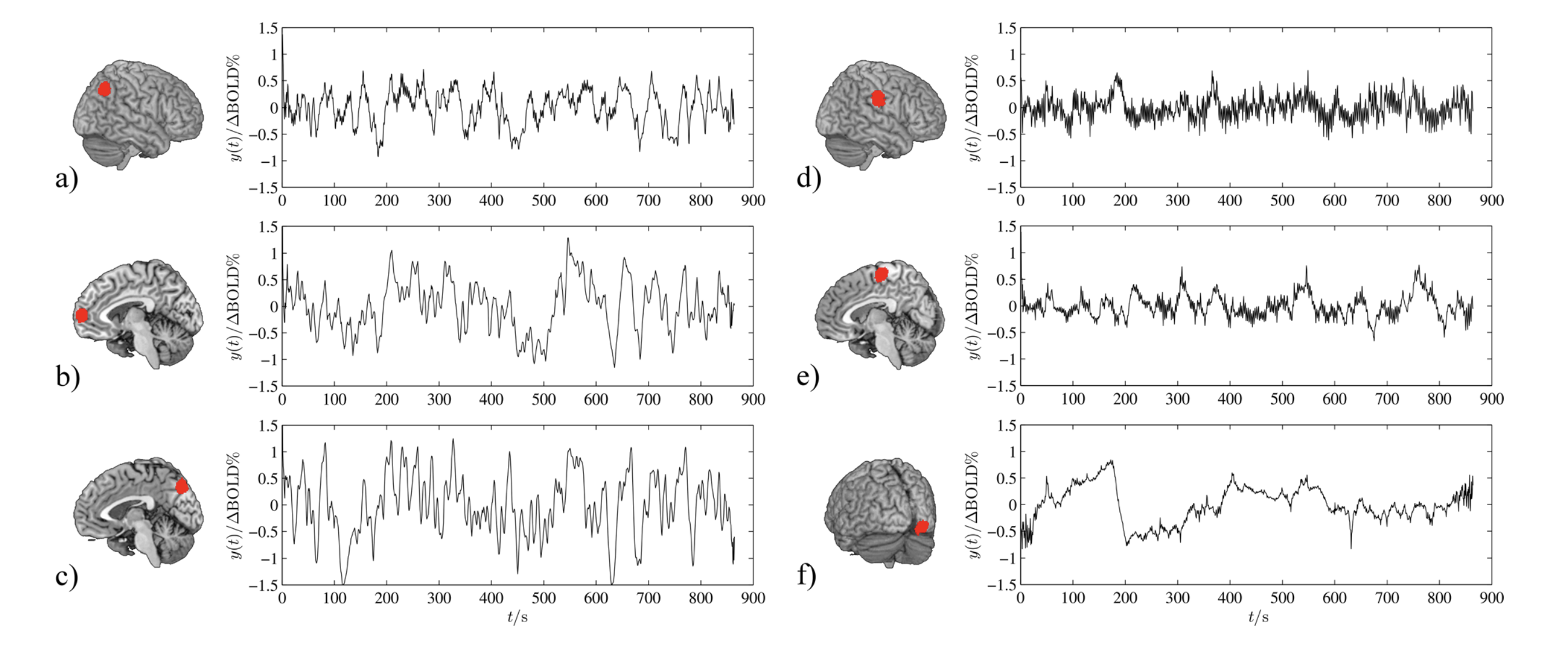Examples of resting-state fMRI time series extracted from six different brain regions. Each plot shows how the fMRI signal changes over time within a particular region of the brain. Reproduced from https://doi.org/10.1063/1.4914938.